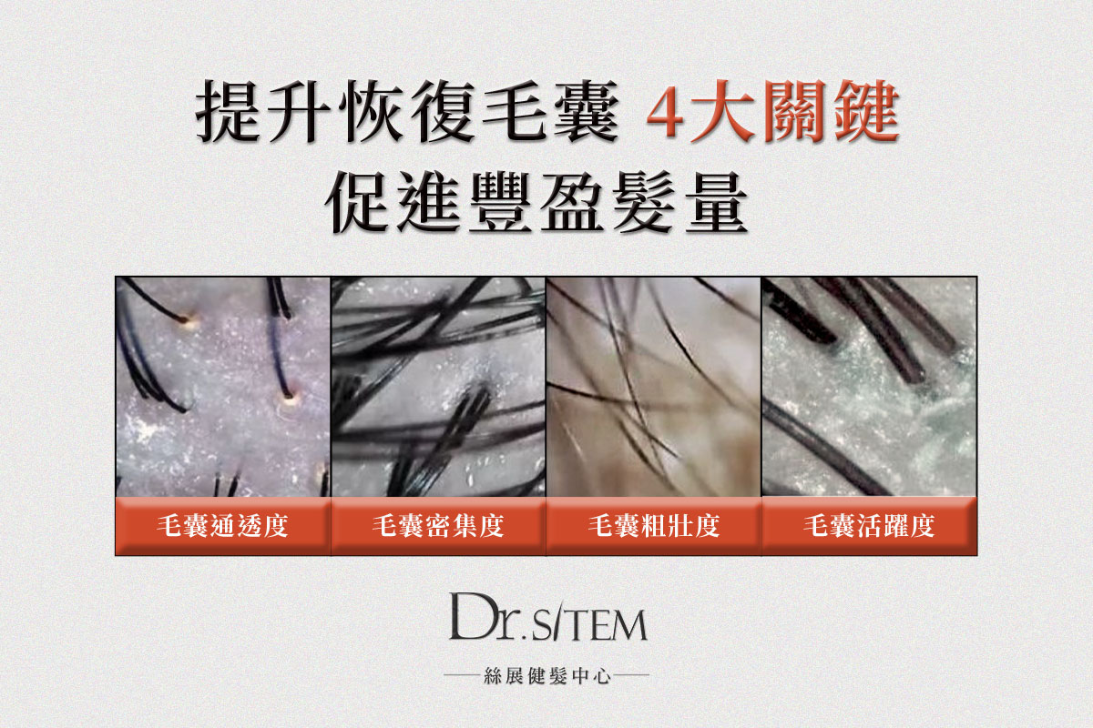 啟動毛囊的關鍵解密：Dr. Sitem絲展的自然生髮管理與頭皮毛囊檢測-生髮關鍵3